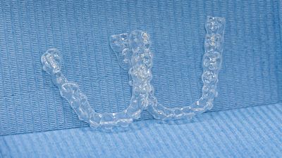 Spark Aligners